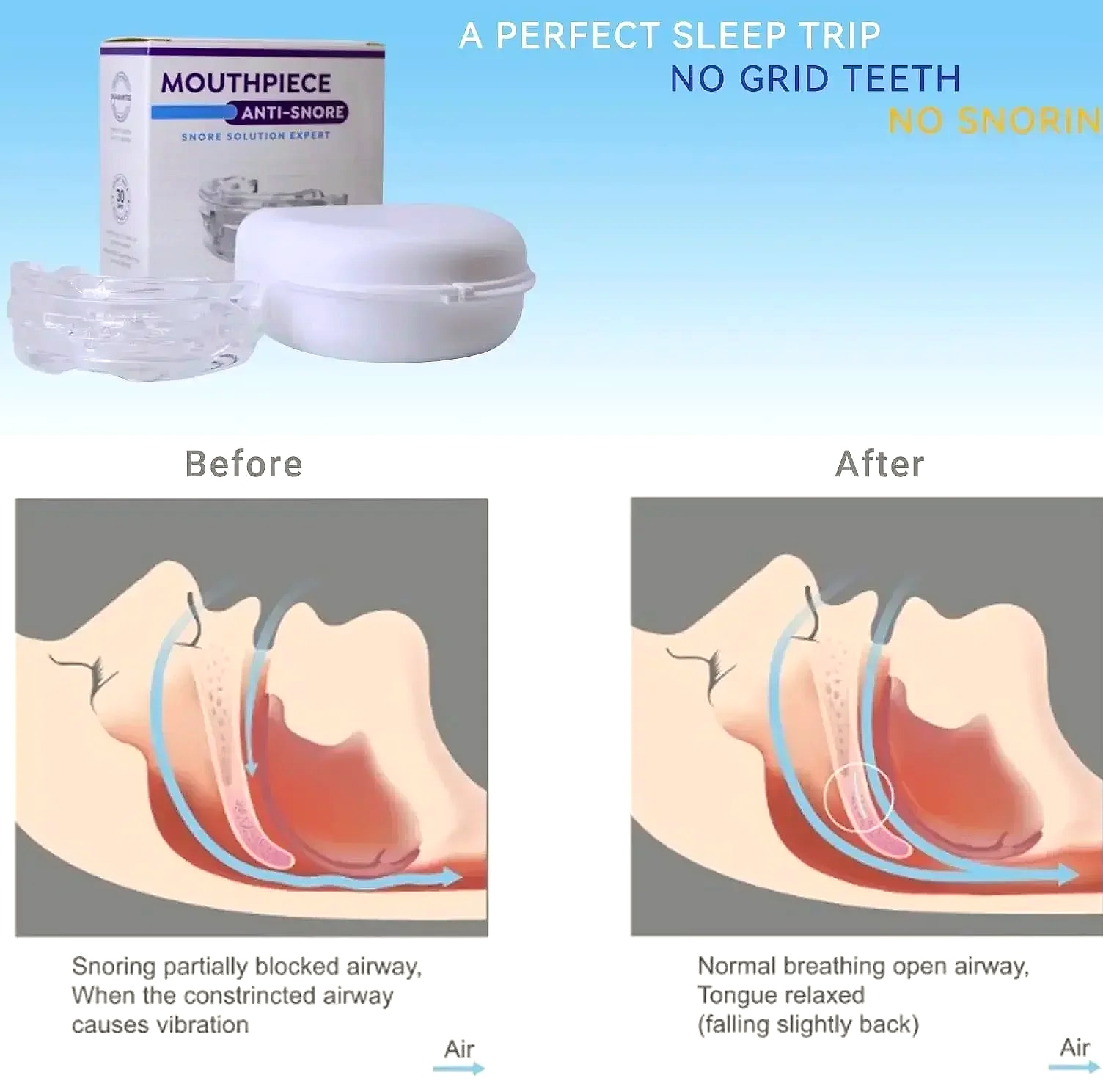 Adjustable Anti-Snoring Mouth Guard for Sleep Bruxism — scale reference