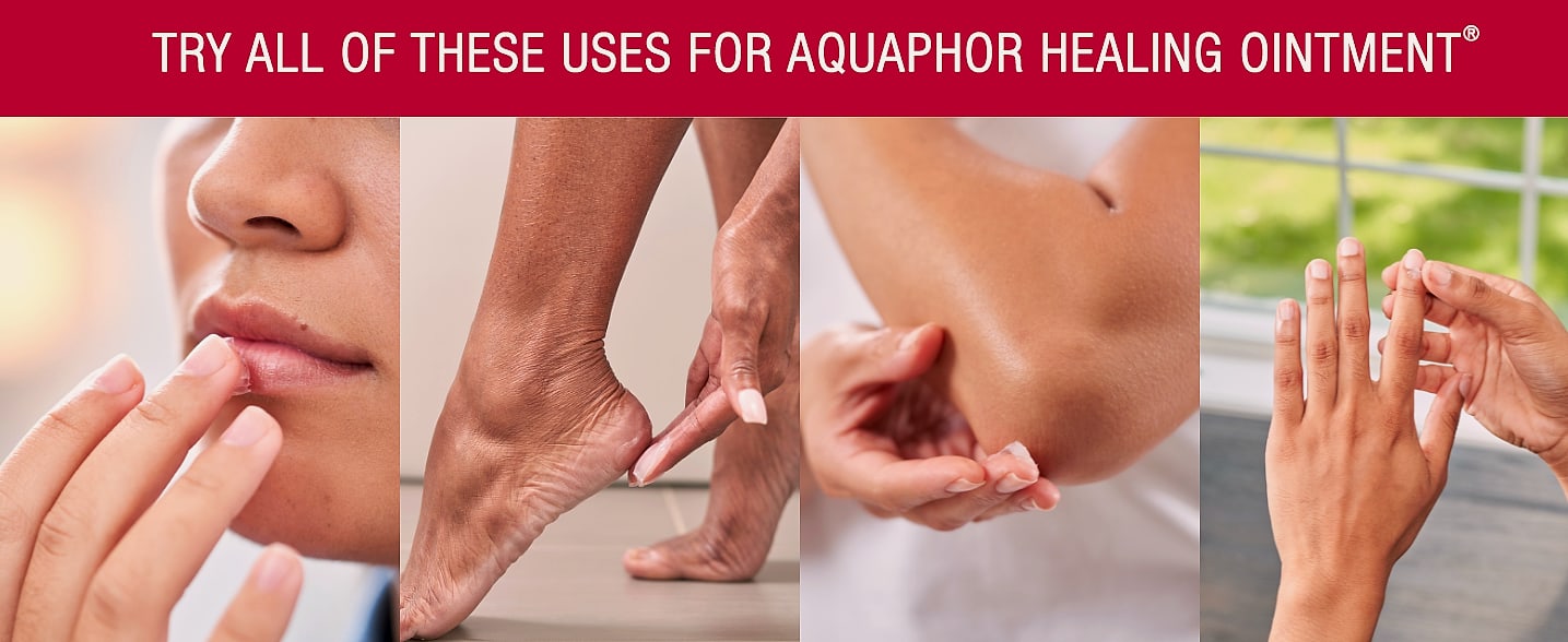 Aquaphor Healing Ointment Advanced Therapy Skin Protectant — close-up details