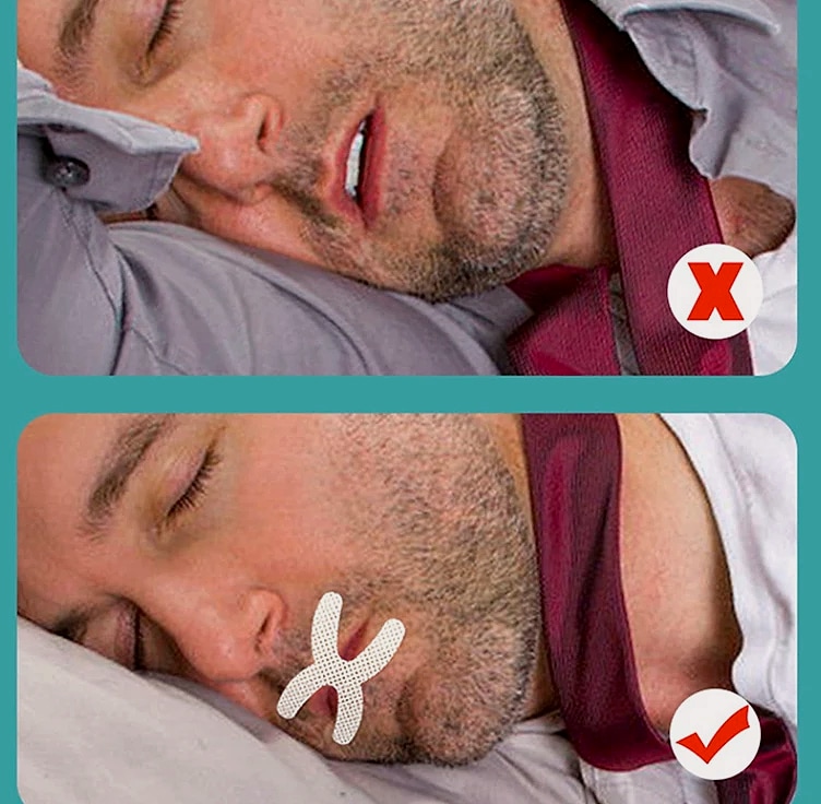 30-Pack X-Shape Mouth Tape Sleep Strips Anti-Snoring — close-up details