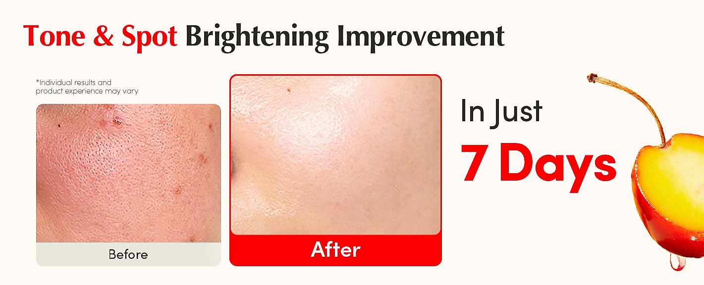 EQQUALBERRY Vitamin C Serum with Niacinamide for Brightening — scale reference